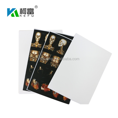 A3 A4 Medical Waterproof Inkjet Film CT CR MR DR Digital X Ray Film
