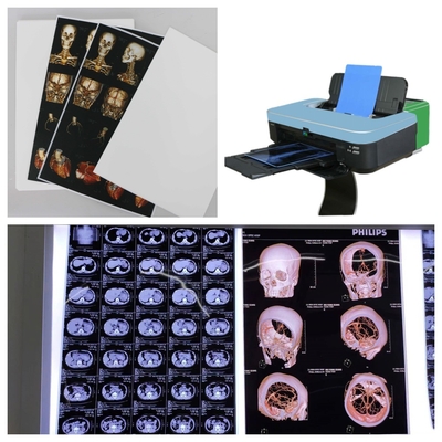 White Opaque Inkjet X Ray Film For Canon/Epson Printers 125/150 Microns For CT MRI