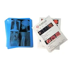 Low Fog Medical X Ray Films High Resolution For Enhanced Diagnostic Precision
