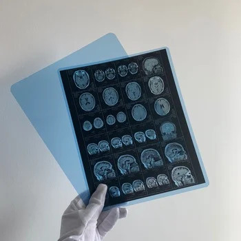 Medical X Ray Dry Film Medical X Ray Inkjet Film With Clear Image Quality