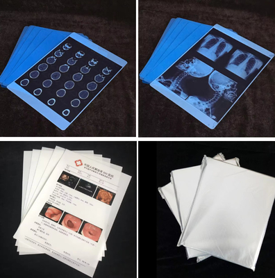 Medical X Ray Film Dry Thermal Film  for Clear Imaging