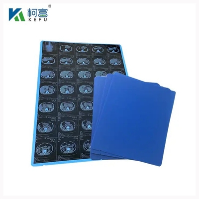 Radiology PET Dry Inkjet Blue Medical Film 8x10 10x12 11x14 14x17 Inch Medical Orthopedic X Ray Films