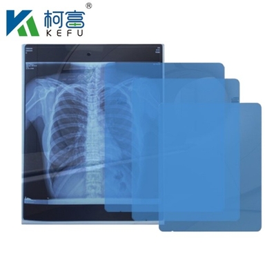 8x10 10x12 10x14 14x17 Inch Medical Dry DIHL Film Laser Xray Film For Clinic And Hospitals