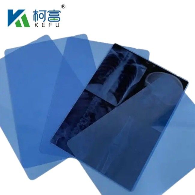 Blue PET Based X Ray Thermal / Inkjet Film Medical Images For Clinic ...