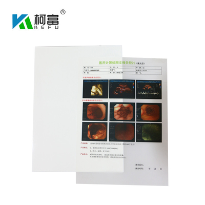 125 Microns White Inkjet X Ray Film A4 B5 16K Inkjet Printing Film