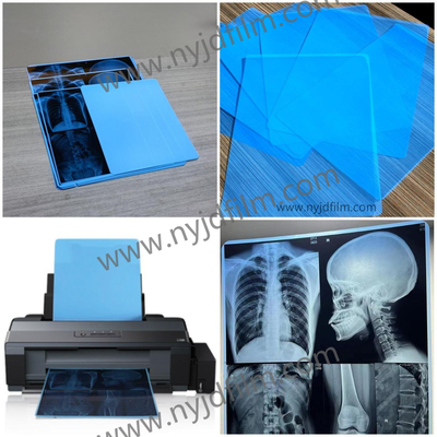 210 Microns Blue X Ray Film Medical Inkjet Printing Film For Hospital