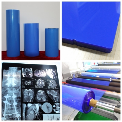 ISO9001 Blue Inkjet Film Medical Inkjet Printing Film 11*14In