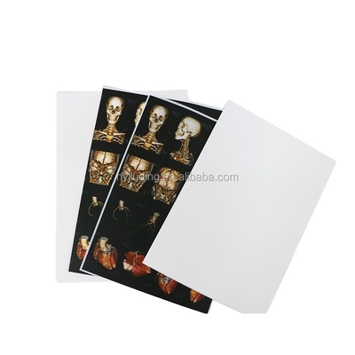 White Base PET Inkjet X Ray Film 150 Microns Inkjet Printing Film