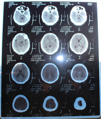 13x17 Inch Digital X Ray Film