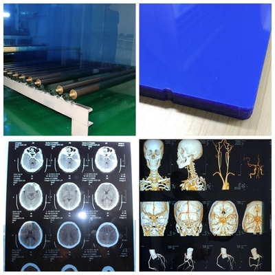 ISO 9001 24 Inch X 30m Medical X Ray Film Blue Laser Transparency Film For Hospitals