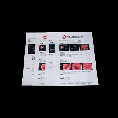 125 Microns Semi Transparent Laser Printing Film A3 A4 A5 Medical Dry Film
