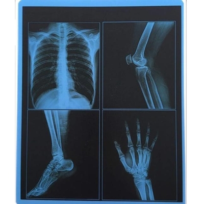 25cm X 30cm Blue Transparency PET Thermal Film Medical Dry Imaging Film For Hospital