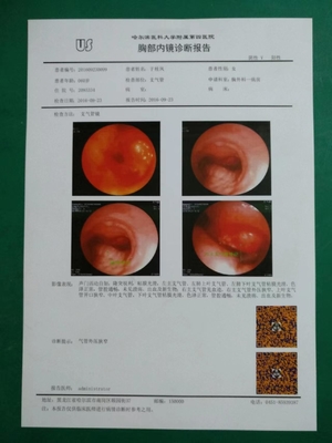 PET Based 125um 150um 180um Medical Dry Film White Inkjet X Ray Film OEM