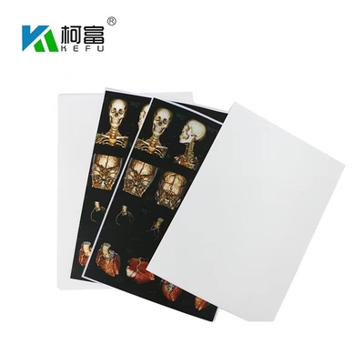 ISO9001 White Inkjet X Ray Film A4 Medical Dry Film OEM