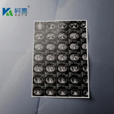 180um A3 White Inkjet Medical X Ray Film Canon Epson Inkjet Printer Film