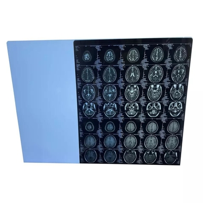 Anti Static Medical Dry Film Fuji Laser Imaging Film 25cmx35cm