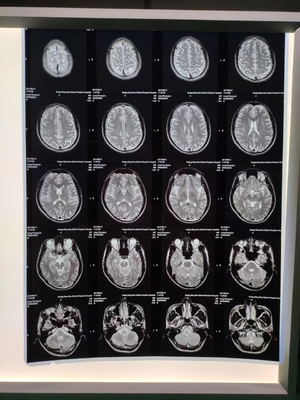 210 Microns Inkjet X Ray Film A3