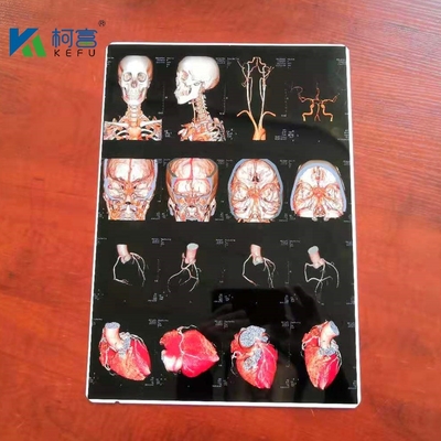 Eco Friendly PET Based Medical Dry Film White Inkjet X Ray Film 150 Microns