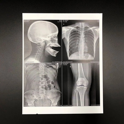 Eco Friendly PET Based Medical Dry Film White Inkjet X Ray Film 150 Microns