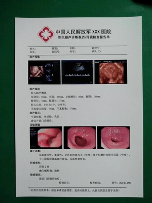 Eco Friendly PET Based Medical Dry Film White Inkjet X Ray Film 150 Microns