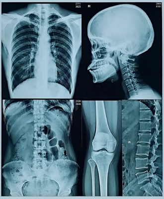 14x17 Inch Fuji X Ray Film