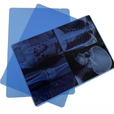 17 Inch Width Medical Film Printer Epson Inkjet X Ray Film Printer