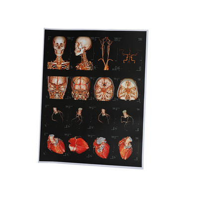 OEM 210um Inkjet X Ray Film
