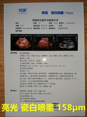 125 Microns White Base Opaque Inkjet Medical Film Three Dimensional CT Scan Film