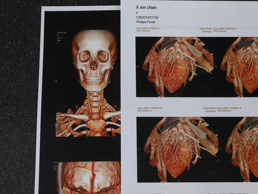 180um Inkjet Printing Medical Dry Film