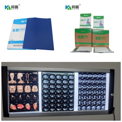 DR CT MRI Medical Inkjet Dry X Ray Films 280gsm Dye Ink 8x10 13x17 A4 A3 Sheets