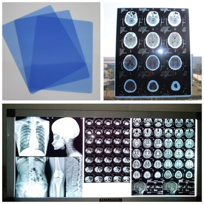 210um Inkjet Medical X Ray Film Blue For Digital DR CT MRI Cassette With Sheets 8x10