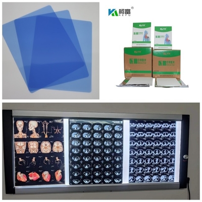 150 Microns Inkjet X Ray Film Printing Speed 1-3 Minutes For Medical 10inch