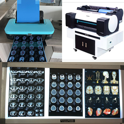 210um Inkjet Medical X Ray Film 3D CT MRI Image Output 8x10 14X17 Inch Blue Base
