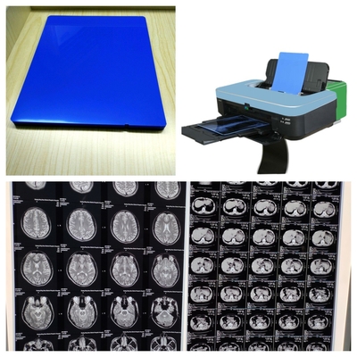 Glossy Inkjet X Ray Film Blue White With 9600x2400dpi Resolution Long Lasting Durability