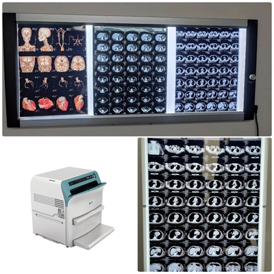 Medical High Resolution X Ray Dry Film 10x12 For DR CT MRI DSA Image Output Compatible With Fuji  Printer