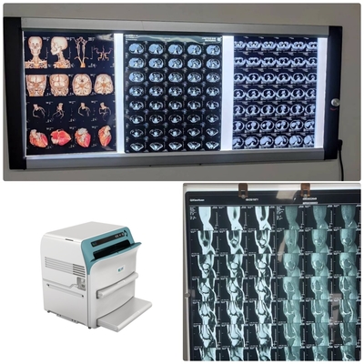 Class I Medical X Ray Film Radiology 14*17 Inch Hospital Blue Thermal Film