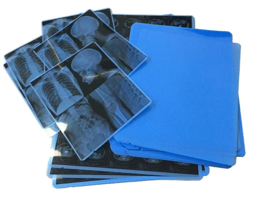 Blue Medical X Ray Film For Inkjet Printers And Clear And Accurate Imaging