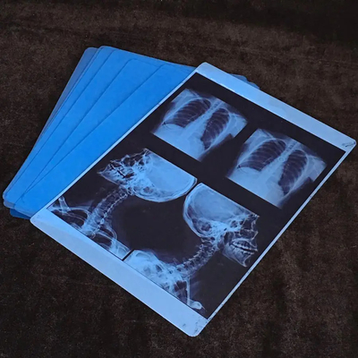 Inkjet Printouts For Medical Imaging With Blue Medical X Ray Film