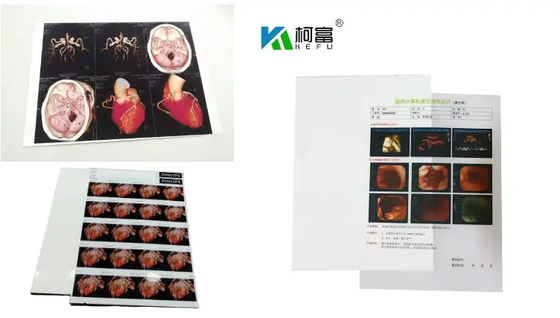 204±8 μM Thickness Medical Dry Film With High Durability ≤20% Haze UV Resistance