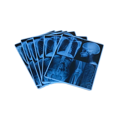 High Image Stability Blue Medical Film Inkjet For Inkjet X Ray Film