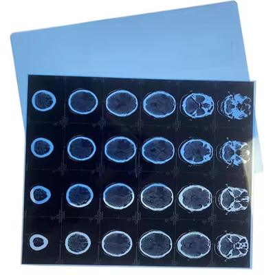 Inkjet Printouts For Medical Imaging With Blue Medical X Ray Film