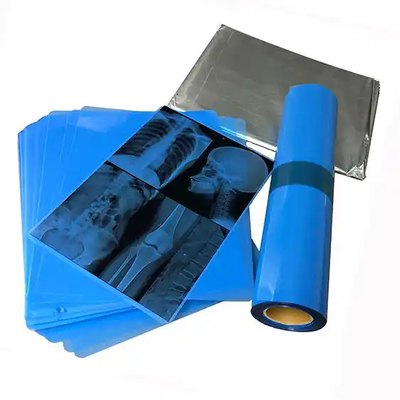 Inkjet Printouts For Medical Imaging With Blue Medical X Ray Film