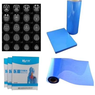 High Sharpness PET X-ray Film For Medical Device Manufacturing