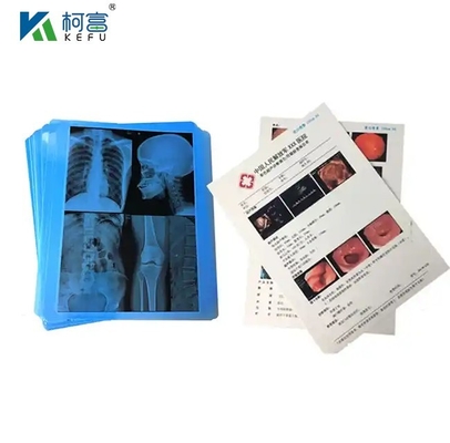CT Scanner Dry X-Ray 24x30 Inch Film Inkjet Green Blue Base Medical X Ray Film