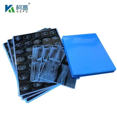 Dicom Software Printing Inkjet X Ray Blue Medical Film For Ct Cr Mr Imaging