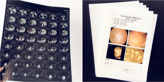 Medical Supplies Laser Print Film White Opaque Medical X-ray Film Image Printing Film For Epson &amp; Canon Inkjet Printer