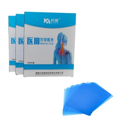 Blue Inkjet Film Medical X-Ray/CT/DR Dry Scan Film For X-Ray Laser Image Printer And Thermal Image Printer Equipment