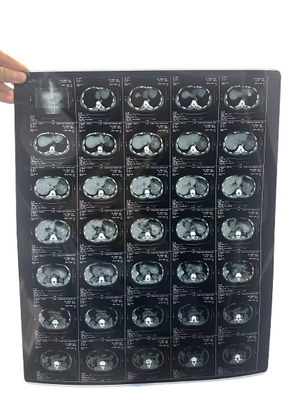 Min Density 0.28D X-ray Film For Accurate And Detailed Diagnostic Results
