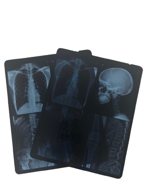 Medical X Ray Dry Film High Sharpness Protective Layer Thickness 200±5μm