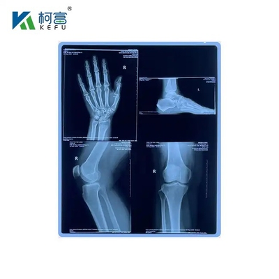 Sharpness High Medical X Ray Film With PET Base And Structure